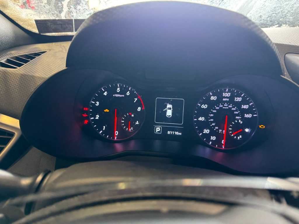 2015-17 Hyundai Veloster Turbo Speedometer Gauge Instrument Cluster 81K Mileage - Alshned Auto Parts
